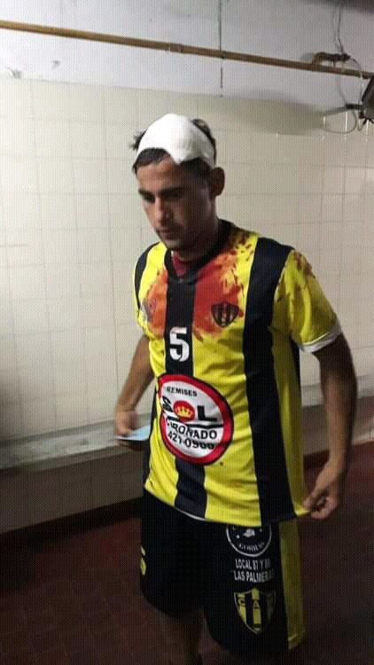 Fútbol de la vergüenza: La liga Concordiense salió a repudiar los hechos violentos (1)